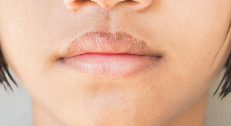 How to keep your lips soft during harmattan [Medical News Today]