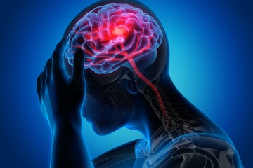 Stroke: a betegek harmada nem éli túl