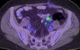 medencei-ct-felvetel-d00000E782680c0df35a6