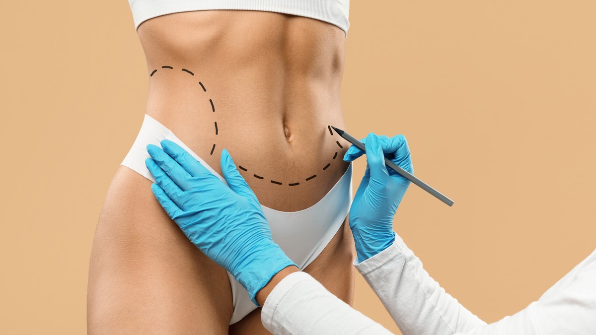 Najpopularniji trendovi u estetskoj hirurgiji u 2026. 