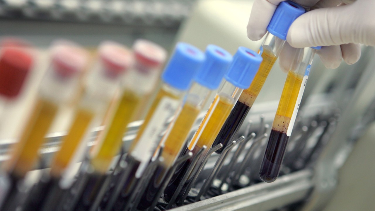 Niemal każdy Holender ma we krwi toksyczne chemikalia. Niepokojące wyniki badań