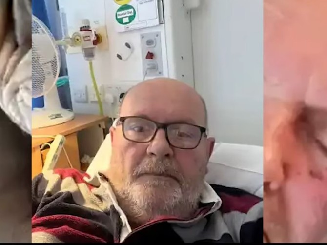 Njemu je pas sažvakao prst dok je spavao