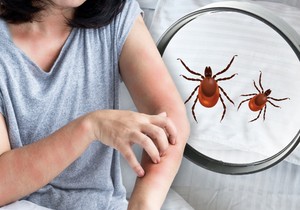 Za razliku od buva, stenice isključivo ujedaju ljude dok spavaju
