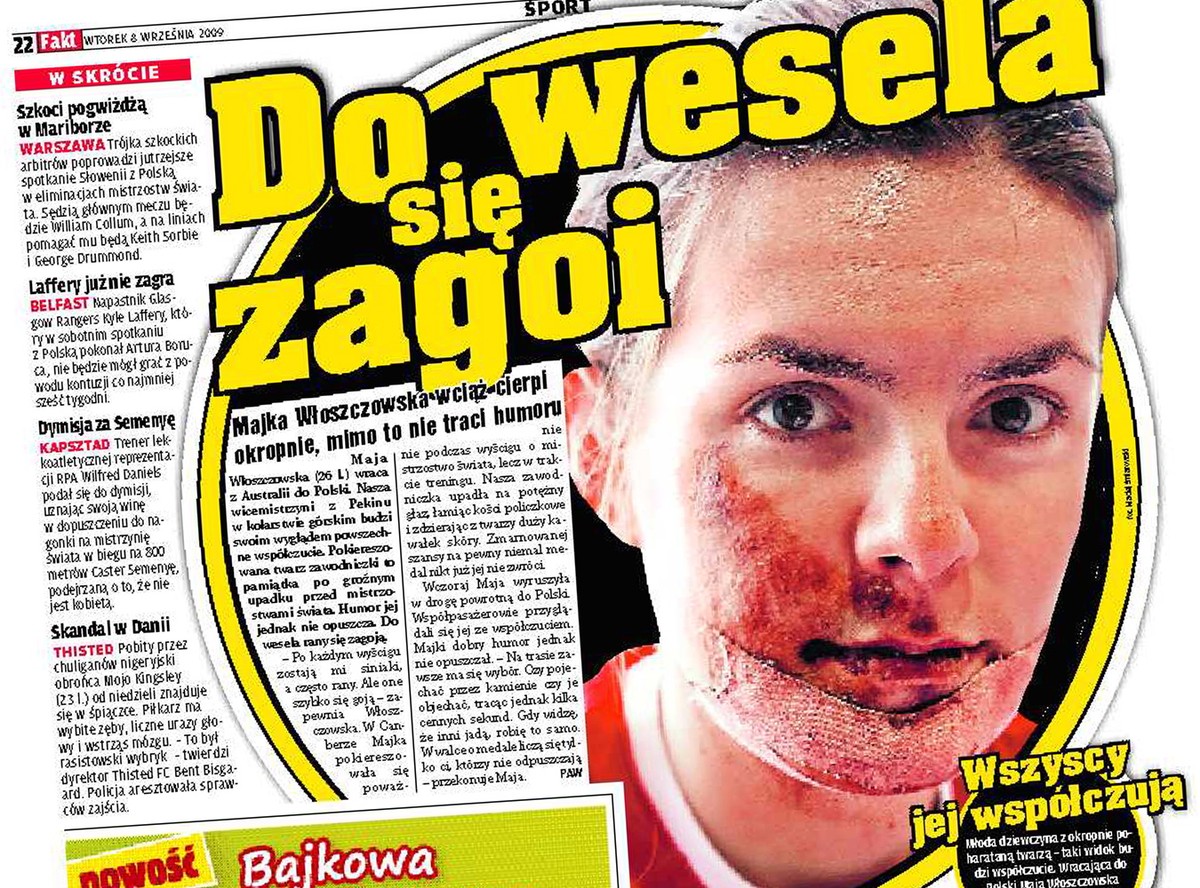 Oto twarz Włoszczowskiej po wypadku