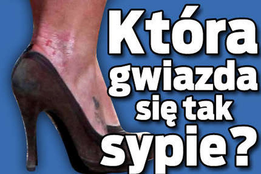 Która gwiazda się tak sypie?