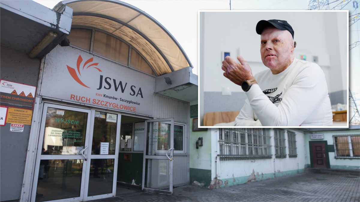Poparzony górnik z Knurowa: kopalnia dała mu 150 tys. zł, on czuje się porzucony