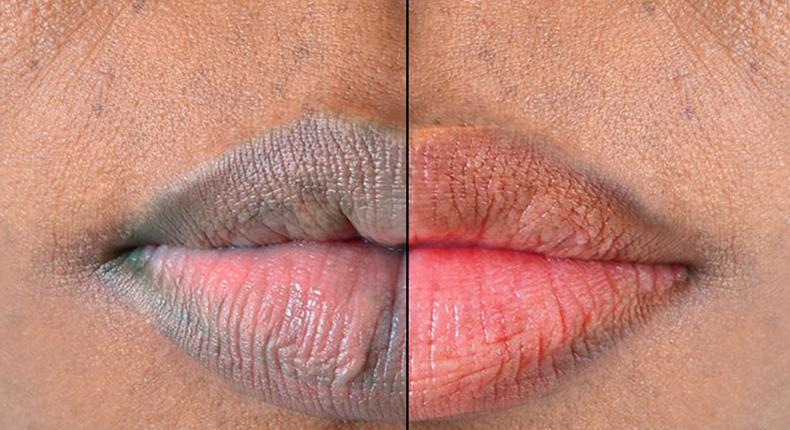 Lips: Here are 5 naturally ways to make them soft and pink [Medium] 