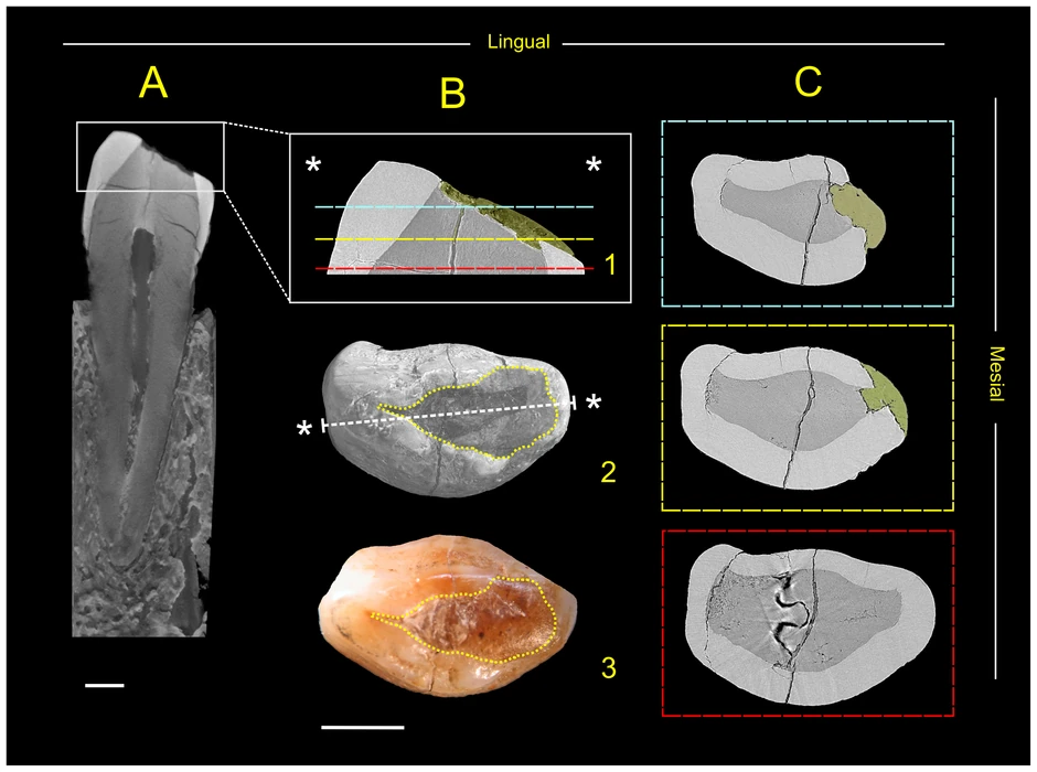 Model plombe od pčelinjeg voska