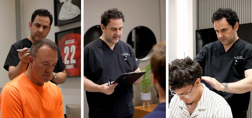 przeszczep włosów, turcja