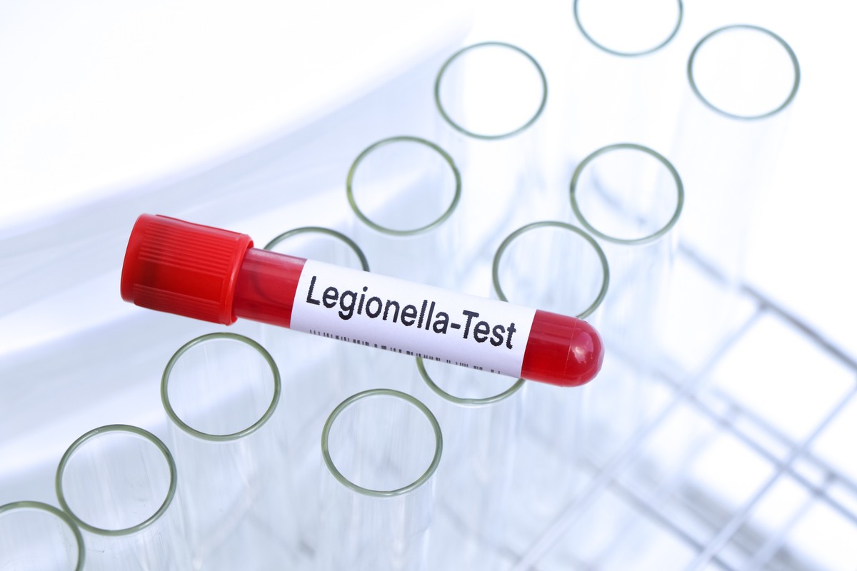 Jak można zarazić się legionellą? Sprawdź, na co najbardziej uważać