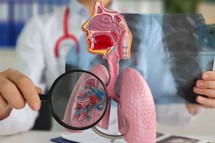 6 milionów Polaków cierpi na choroby płuc. Ta jest najczęstsza