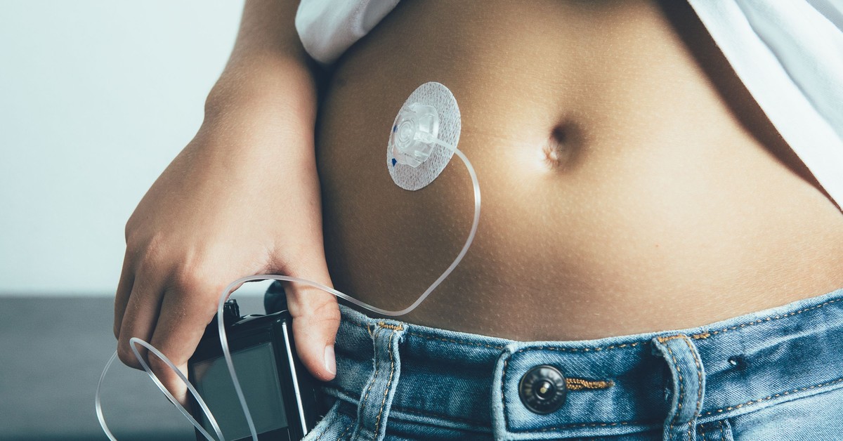 Refundacja pomp insulinowych i systemu CGM dla osób po 26. roku życia. RPO pyta, co się zmieni. Czy to koniec nierówności?