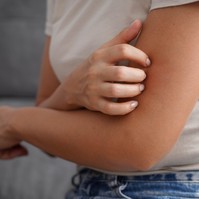 Kellemetlen, viszkető piros kiütések: ezt tehetjük, hogy elmúljon a melegkiütés