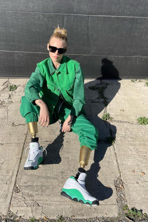 Krásna modelka prišla o obe nohy.