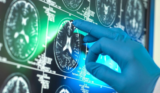 BBC | Foto: Getty Images