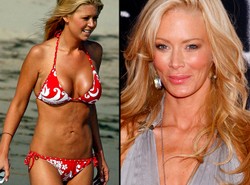 Najwstrętniejsze części ciała gwiazd