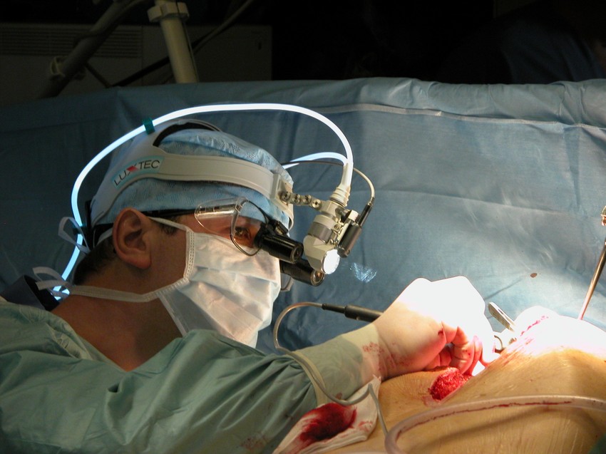 Doktor Jonjev prilikom jedne operacije