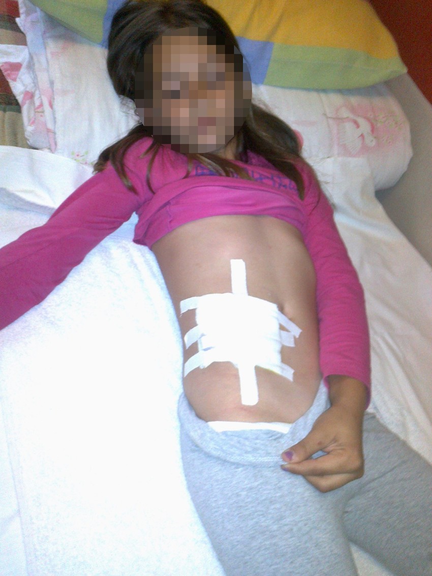 Hana Jovanović ima povredu stomaka