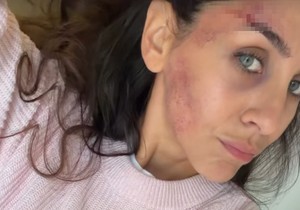 Ivana Dudić, povreda