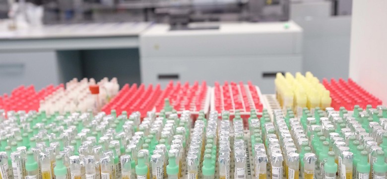 Włosi przeprowadzili najwięcej testów w przeliczeniu na liczbę mieszkańców