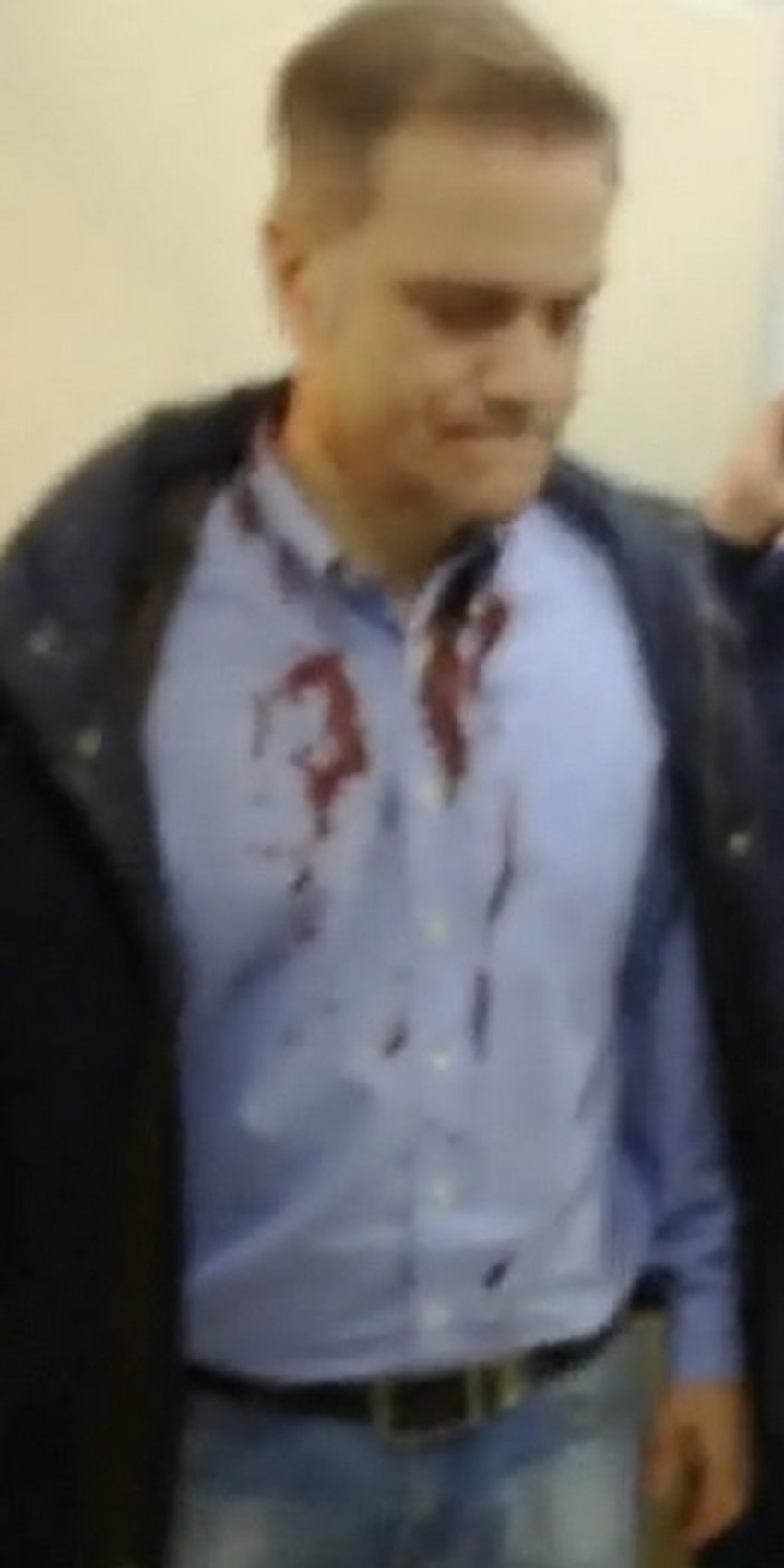 Borko Stefanović nakon napada