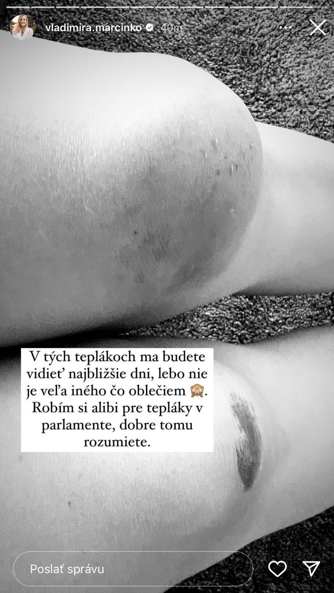 Slovenská poslankyňa Vladimíra Marcinková mala menšiu nehodu. 
