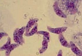 toxoplasma-d00001809a486d773c69b