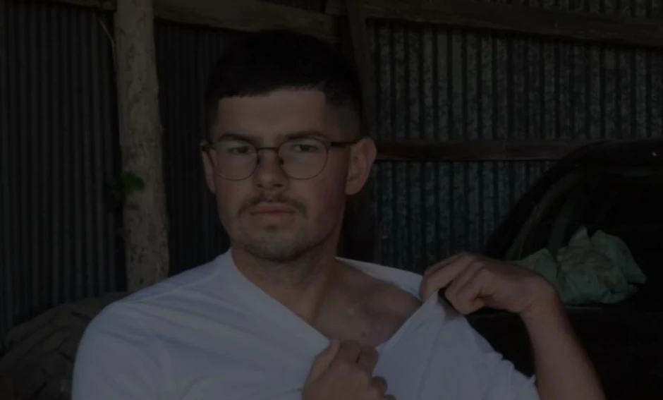 Tom pokazuje ranu od vazdušnog jastuka