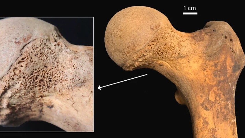 Tragovi kanabisa na femuru