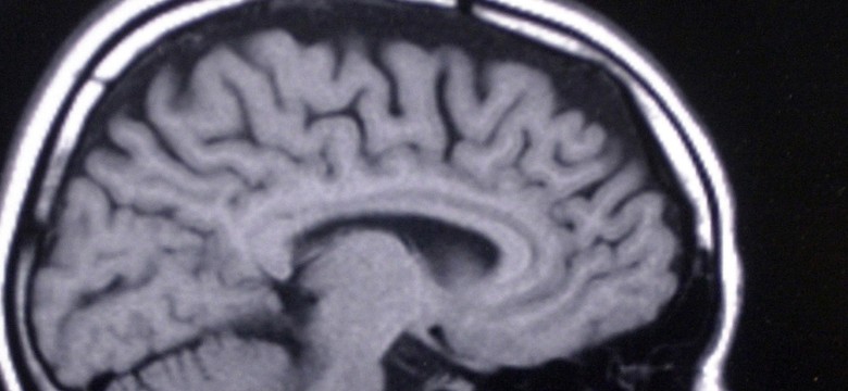 Naukowcy znaleźli w mózgu miejsce poczucia winy