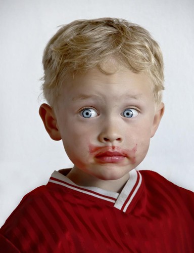 Burak przeciwko anemii