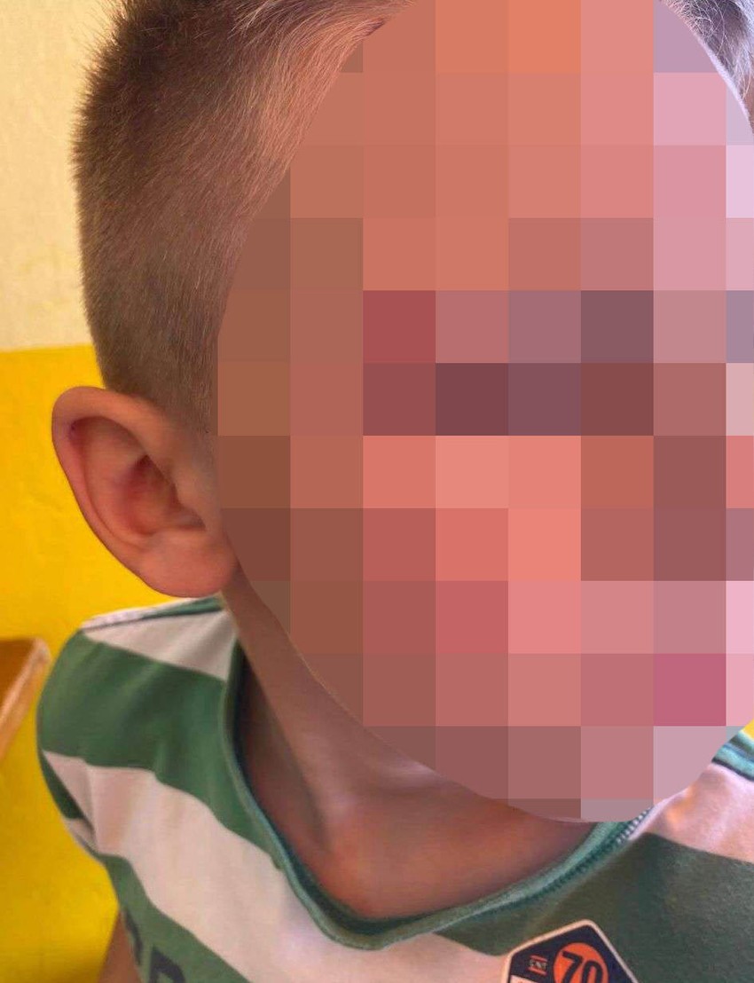 Dečak povređen u Šapcu