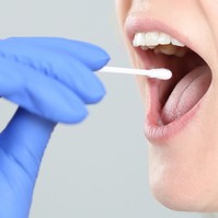 Ennyire sok mindent meg lehet tudni egy nyáltesztből