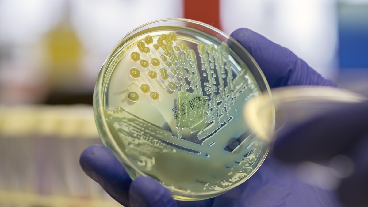 Microbiologist examining a multi-drug resistant coliform (Klebsiella pneumoniae) bacteria on CLED ag