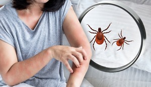 Za razliku od buva, stenice isključivo ujedaju ljude dok spavaju