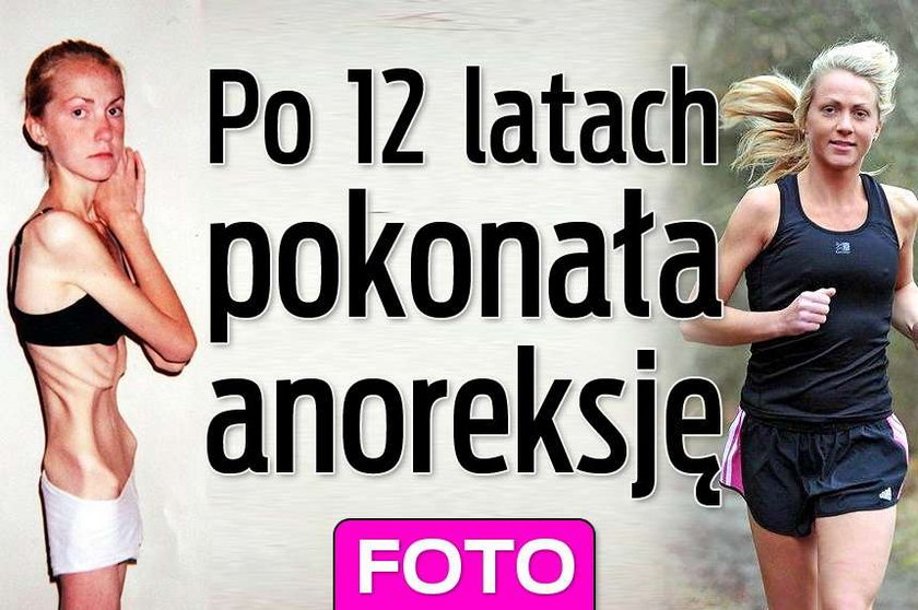 Po 12 latach pokonałam anoreksję