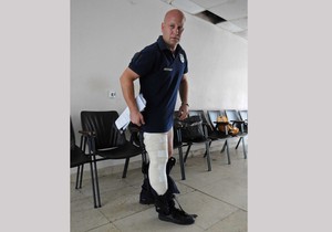 647548_kragujevacpovredjeni-komunalni-policajac-boris-djokic300715ras-foto-nebojsa-raus03