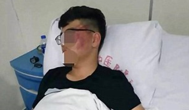 Dečak završio u bolnici