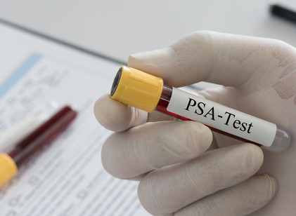 Prosztatarák: ezt az értéket nézesse meg a vérvételkor! című cikk nyitóképe