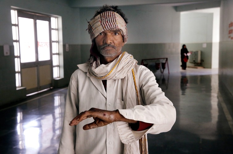 Tradycja i skręcane papierosy beedi powoli zabijają Hindusów