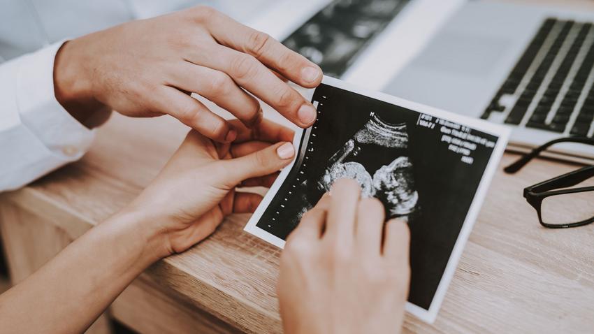 várandósság terhesség köldökzsinór orvos válaszol