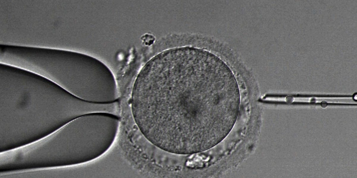 Zapłodnienie in vitro.