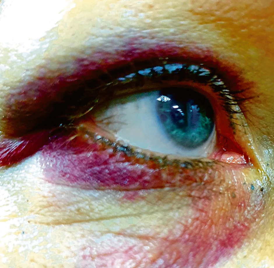 Emiliju Petrović je nasilnik V. S. tukao 12 sati i držao je zaključanu u stanu. U besu i pijanstvu joj je čak glavu udarao o kuhinjske elemente 