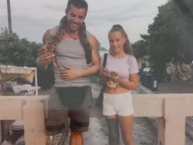 Marija Filipović je imala 6 godina kada joj je amputirana noga zbog sarkoma
