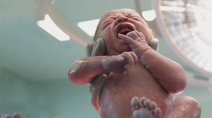 Élen járunk a császármetszéses szülések arányát illetően az EU-ban / Illusztráció: Shutterstock