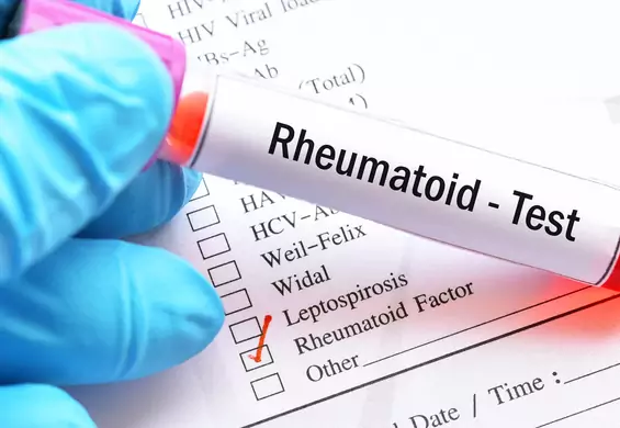 Badanie RF, czyli czynnik reumatoidalny