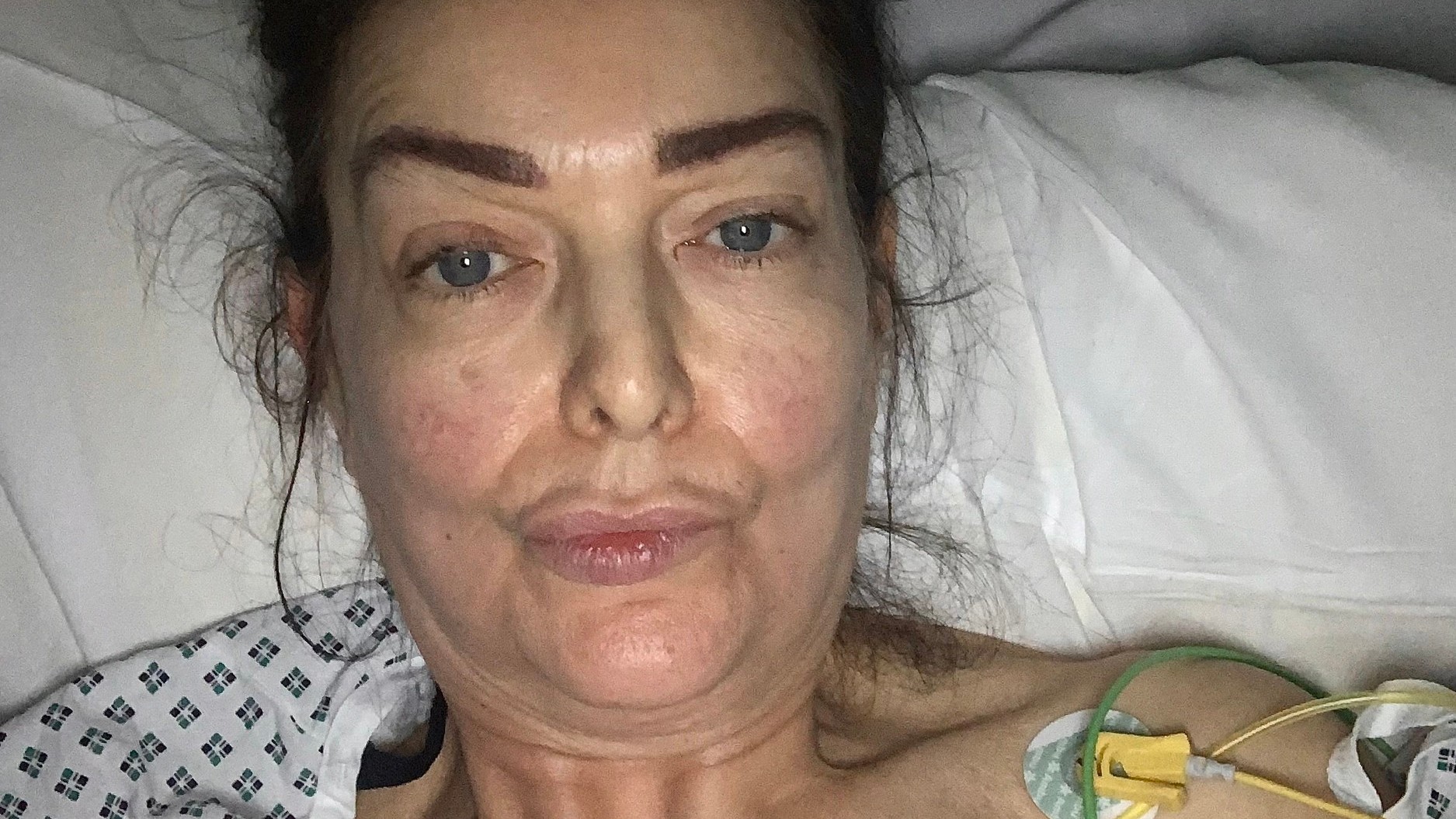 Natalie Hushin varuje pred rakovinou hrubého čreva, ktorú si pôvodne pomýlila s príznakmi menopauzy.