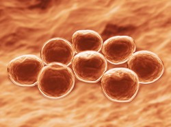 Obecny u zwierząt antybiotykooporny SZCZEP GRONKOWCA zaczyna zagrażać ludziom