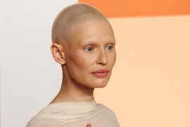 NAJPRIVLAČNIJA ŽENA NA SVETU na oskarovsku žurku došla u prozirnoj haljini i svima POKAZALA BRADAVICE: Posle hemoterapije je izgubila kosu i obrve, ali ne i čudesnu lepotu