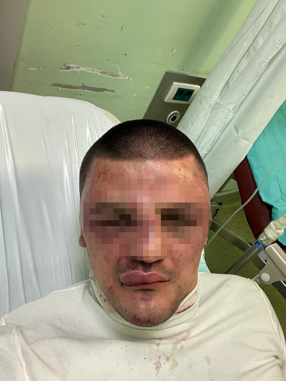 .Ognjenovo lice prekriveno je podlivima, modricama i krvlju